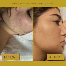 Huge weight lifted off my shoulders today...so a little self care this  evening for my extremely dry face..nothing a little exfoliation won't fix!  My favorite mask 😍🥰