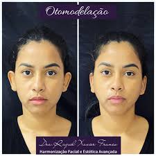 Dra. Raquel Xavier Franco