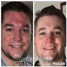 BANILACO Weibo_Update 🌿Seasons change, skin lights up the "spring  sensitivity" red light, makeup removal becomes a problem❓With  #ChengYiBanilan Global Brand Spokesperson# Let's soothe sensitive  skin🌸#SoothingRednessRepairPRO# Specialized for natural ...