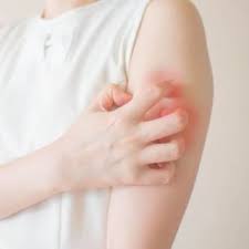 Image result for Dermatomyositis