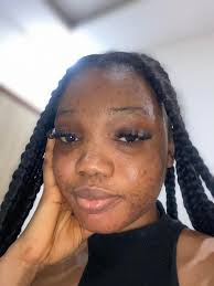 Someone should please make my face really clear