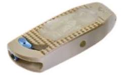 Far Lateral Lumbar Spine Fusions | Oblique Lateral Interbody ...