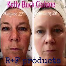 Rodan + Fields- Catherine Bost, Independent Consultant