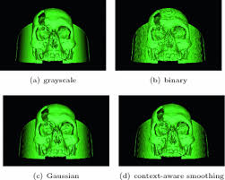 Invesalius is a free medical software used to generate virtual reconstructions of structures in the human body. Invesalius An Interactive Rendering Framework For Health Care Support Springerlink