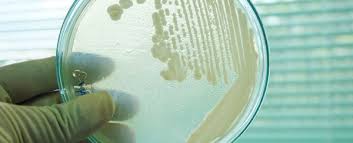 Image result for Buchnera candida