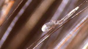 How long does it take time taken for four eggs to hatch in minecraft without having to speed the progress is approximately three days. Video Secrets Of Head Lice And How To Beat Them Shots Health News Npr