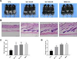 How to grow your hair super freaking long—and fast. Shikimic Acid A Mannose Bioisostere Promotes Hair Growth With The Induction Of Anagen Hair Cycle Scientific Reports