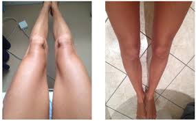 73 Self Tanners Ideas Self Tanners Tan Tanning Tips My newest favorite is the vita liberata fabulous self tanning gradual lotion. 73 self tanners ideas self tanners