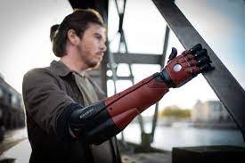 Also known as automail or metal arm prosthetic arm / metal arm is an item that replaces your lost arm. The Hero Arm Is A Prosthetic Arm Made By Open Bionics