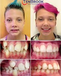 TenBrook Orthodontics (@tenbrookortho) • Instagram photos and videos