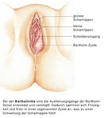 Bewerber und bewerberinnen mit entsprechender qualifikation senden ihre bewerbung bitte über das bewerbungsformular auf der website. Bartholinitis Bartholinzyste Entzundung Der Bartholindrusen Eesom Gesundheitsportal