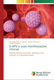 O que exatamente é o hpv? O Hpv E Suas Manifestacoes Clinicas Papilomavirus Humano Doencas Que Causam E E Possivel Evitar Amazon Es Lima De Oliveira Fernanda Monteiro Mayara El Hakim Soraya Libros En Idiomas Extranjeros