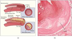 Pictures and 3d models played a great role in helping me learn. Cardiovascular System Circulatory System Parts And Functions