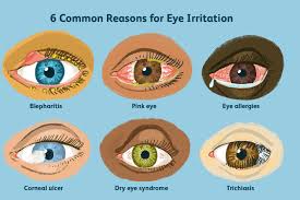 Image result for Eye Pain