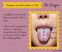 Diagnosis By Observation Of The Tongue In Tcm Tcm Tcm Traditional Chinese Medicine Chinese Medicine