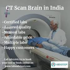 Worried about paying for your ct scan? 60 Off On Ct Scan Brain Cost Starting From 1190 Only