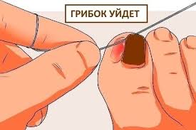 как очистить кровь в домашних условиях за один день Etot Recept Prosto Chudo Vsego Za Odin Den Vy Izbavites Ot Boli V Sustavah Zdorove Mikoz Vrachi