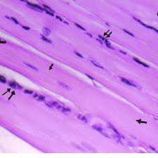 A photomicrograph of a section of the gastrocenemius muscle of control...