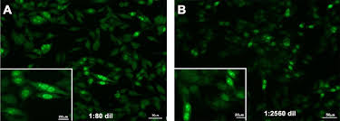 Image result for ANA Staining Pattern