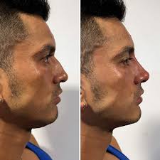 Dr.Robert Bolivar Marquez