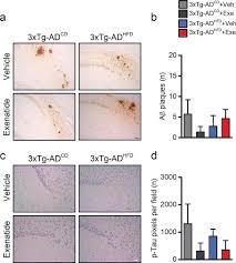 Exenatide Reverts The High Fat Diet Induced Impairment Of