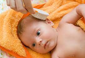 If you are wondering how to get rid of dry scalp, you should that the right way of treating it is. Baby Hair Loss Reasons Tips To Prevent