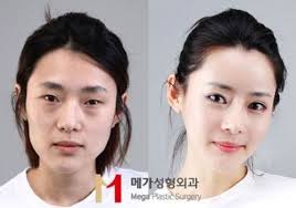 South korea's exacting beauty standards are the result of several factors that have combined to encourage women to aim for pale skin, big eyes, . Korean Beauty Standards Another Pressure Point Koreabridge
