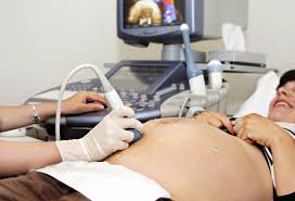 The size of the embryo at 6 weeks pregnant. 34 Weeks Pregnant Symptoms Tips Baby Development