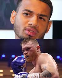 ROLLY ROMERO CRITICA AL CANELO "Está sacando provecho del boxeo, es triste  ver a un gran peleador, una leyenda, allá afuera solo intentando sacar  provecho del boxeo de cualquier manera. Honestamente, es