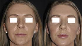 Frank Wasserman's Instagram, Twitter & Facebook