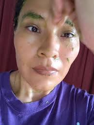 Mascarilla Therapy Guatemala