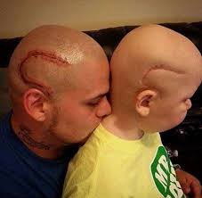 The eu's chemicals watchdog has concluded that substances found in tattooing inks pose a cancer risk and member states will have to vote on restrictions for 4,000 chemicals so what is the evidence of tattoos causing cancer? Dad Gets Tattoo To Match His Young Son S Surgery Scar World News India Tv