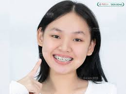 CÁCH LẤY THỨC ĂN DÍNH TRONG RĂNG HÀM VÀ 5+ BIỆN PHÁP PHÒNG TRÁNH THỨC ĂN  GIẮT VÀO KẼ RĂNG