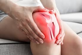 Image result for gout symptoms knee