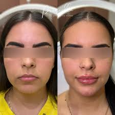 Aesthetic Nurse Priscilla, 358 John Street, , Thornhill, Ontario L3T 5W5,  CA