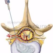We did not find results for: Bandscheibenvorfall Doccheck Flexikon