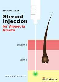 Pin On Hair Loss Remedies Treatments