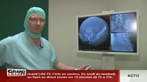 Créé en 1991, le service de neurochirurgie de la clinique de l'union est actuellement constitué d'une équipe de 6 neurochirurgiens, réalisant plus de 3500 procédures chirurgicales par an. Objectif Sante La Chirurgie Du Rachis Assistee Par Ordinateur A Lille Video Dailymotion