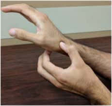 Image result for Scaphoid Fracture Signs