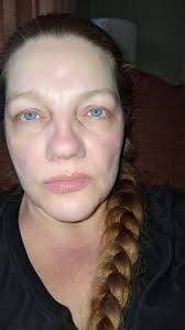 Wearing the head and nose is finally hidden lol 💜