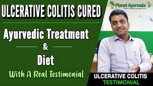Case Study No 149 Ulcerative Colitis Ms Hansa