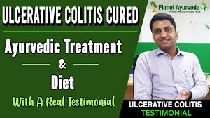 case study no 149 ulcerative colitis ms hansa