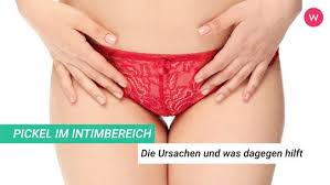 Erbsengroßer pickel an den kleinen schamlippen, diskussion erbsengroßer pickel an den kleinen schamlippen mit der fragestellung: Pickel Im Intimbereich Die Ursachen Und Was Dagegen Hilft Wunderweib