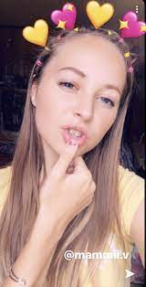 Braces White Braces Aesthetic Brace Face Girls With Braces Rubber Band Hairstyles Rubber Band Hairstyles Hair Styles White Braces