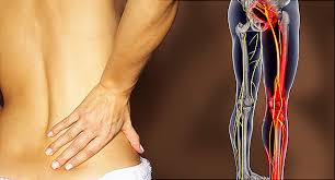 At the back of the lower body are the buttocks for sitting on. Sciatica Pictures Symptoms Causes And Treatments