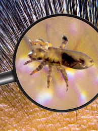 Sonhar com Piolho: Veja O Que Significa e Como Agir