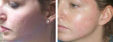 Pin On Home Remedies