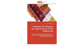 La rupture pourra être contenu par les structures avoisinantes ou entraîner un choc hémorragique. Prediction De La Rupture Des Anevrismes De L Aorte Abdominale Prise En Compte De L Anisotropie De La Paroi Arterielle De La Presence Du Thrombus Et Omn Univ Europ French Edition Toungara Mamadou 9786131596643 Amazon Com