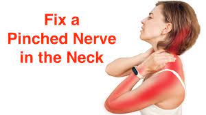 Fix A Pinched Nerve In The Neck (With Free Exercise Sheet!) - Youtube