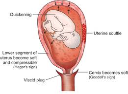 Bimanual examination with two fingers in the anterior fornix and the fingers of the other hand on the abdomen behind the uterus, the internal and external fingers can be approximated due to the fact that the lower segment is soft and empty. Jaypeedigital Ebook Reader